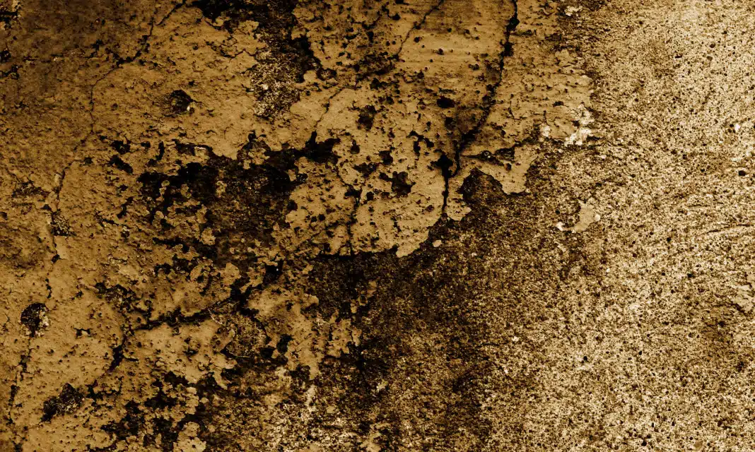 Jak długo boli po usunięciu woreczka żółciowego?